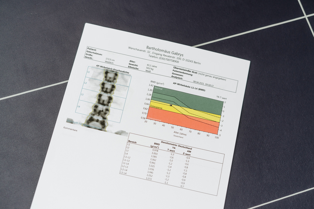 Orthopädie Friedrichshain - Bartholomäus Gabrys - Knochendichtemessung
